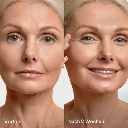 Somiva NaturLift™ Lifting Maske
