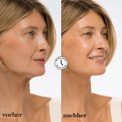 Somiva NaturLift™ Lifting Maske